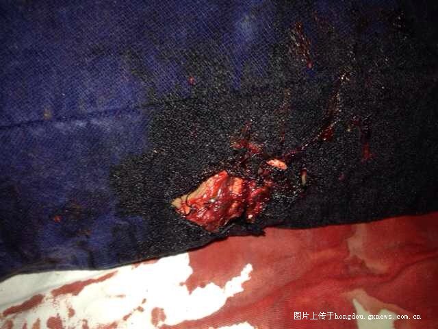 27号晚上合浦美人鱼附近某药店门口发生了一