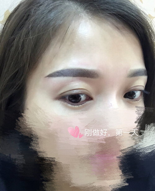 忍不住了,终于去做了半永久的雾眉