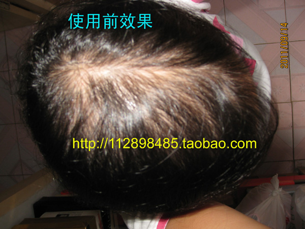 男女假发:高仿真头皮+100%真人<em>头发</em>,自然逼真