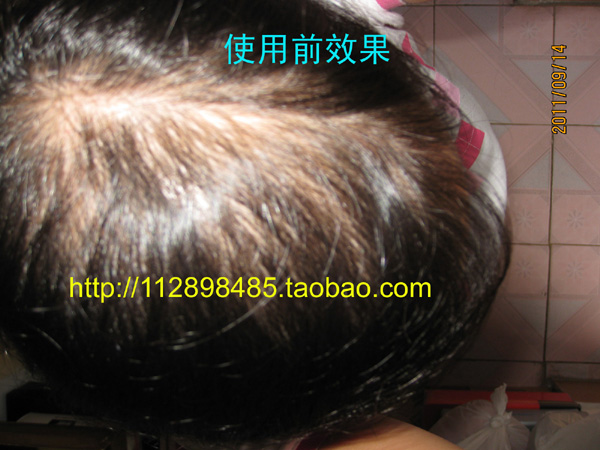 男女假发:高仿真头皮+100%真人<em>头发</em>,自然逼真