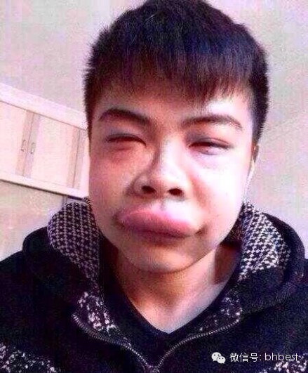 【我和你吻鳖】广西GG和鳄龟<em>接吻</em>被咬成香肠