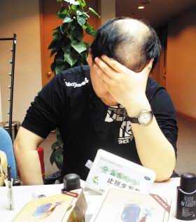 男人脱发怎么治    还你一头浓密黑发-房屋出租