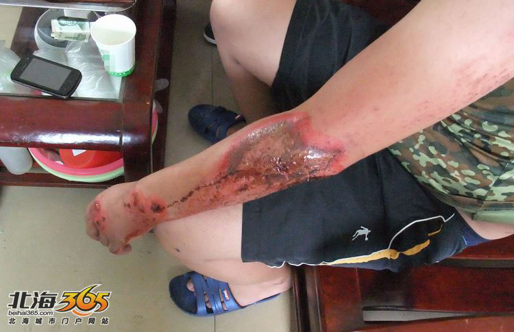 巡逻协警廖均清,谢伟强讲述舍命追捕飞车抢夺砍手嫌犯的详细过程