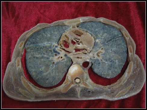 人体奥秘科普展(南宁地区) 【补充.】