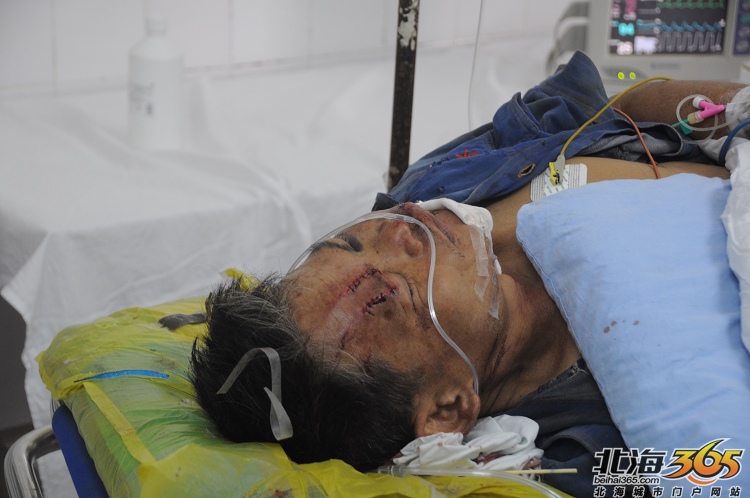 启东商场民工从六楼施工坠楼事件医院伤情启东商场施工现场图伤者已