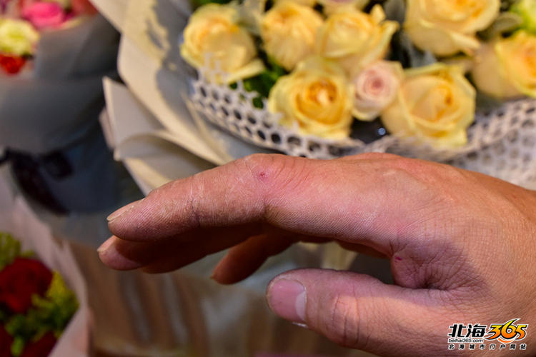 花店店员的手通常很粗糙,手指布满了各种新旧交织的刺伤