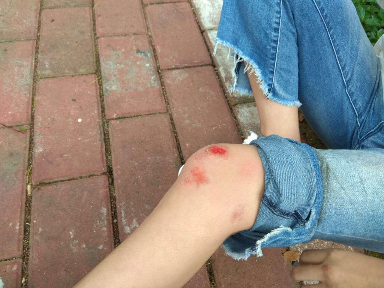 一女士骑电动车被电动车撞倒并且受伤